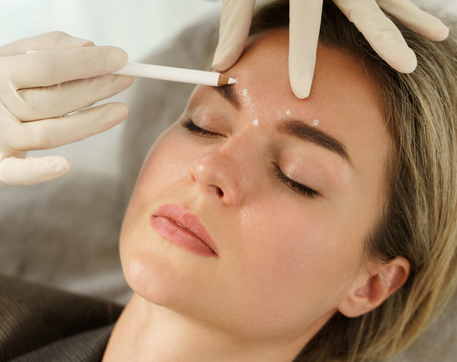 botox a temprana edad