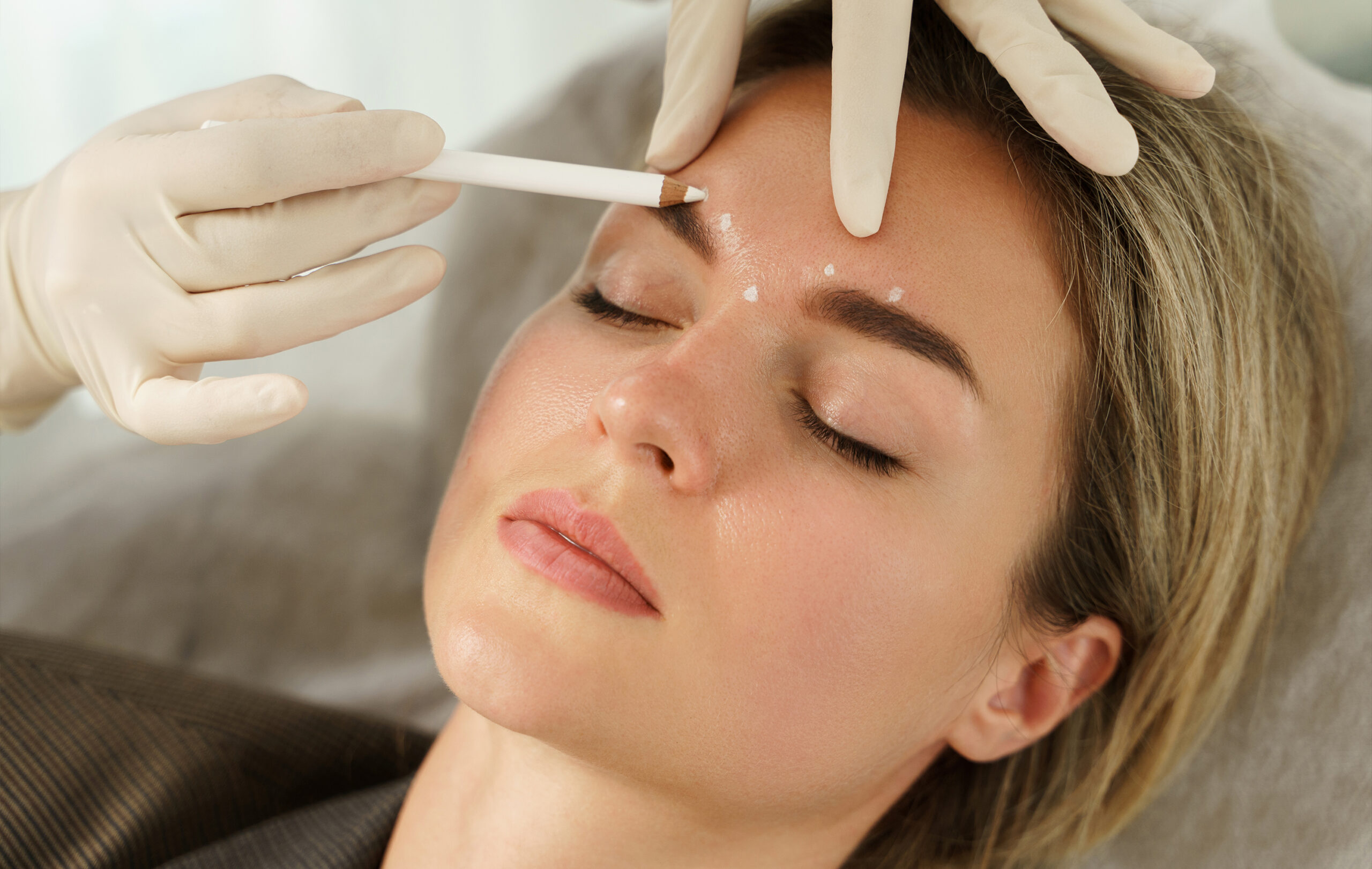 botox a temprana edad