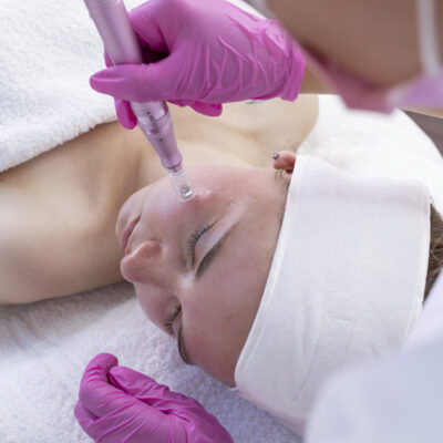 microneedling update 2024