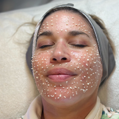 Cellstory liquid microneedling