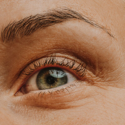 is eye cream working