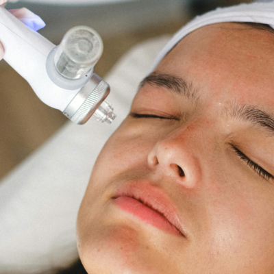 hydrafacial, facial, tratamientos faciales, beneficios del hydrafacial