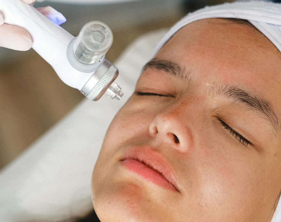 hydrafacial, facial, tratamientos faciales, beneficios del hydrafacial