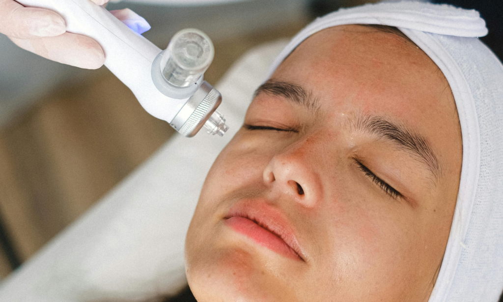 HydraFacial, tratamiento facial, facial, tratamiento facial