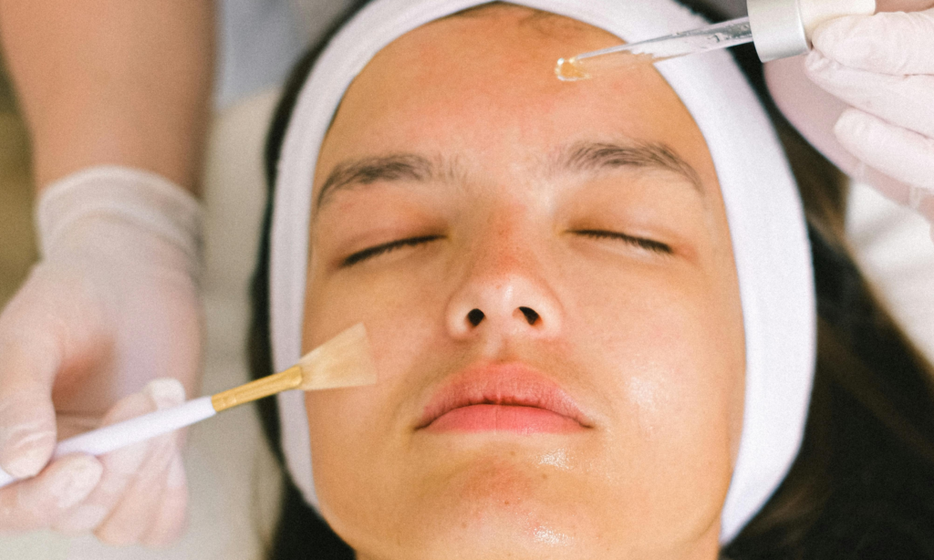Peelings Qu&iacute;micos, tratamientos faciales, cuidado de la piel