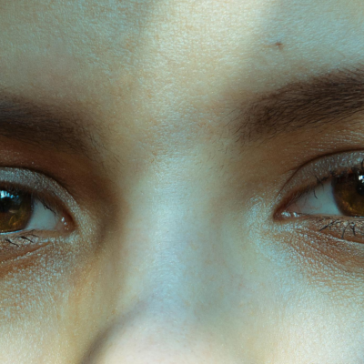 primer plano de mujer con ojeras