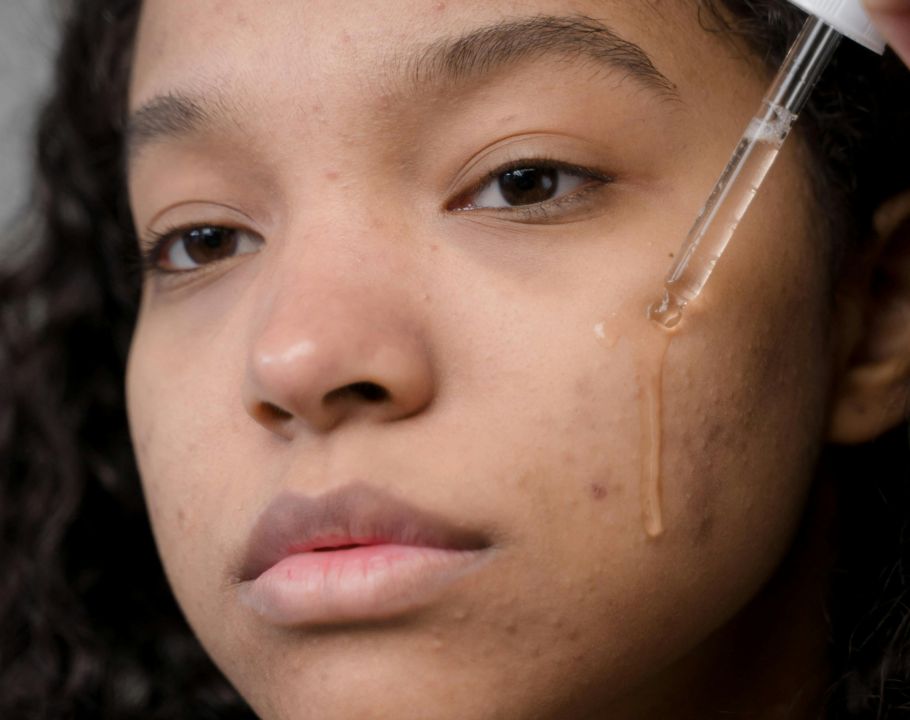 suero facial ácido tranexámico