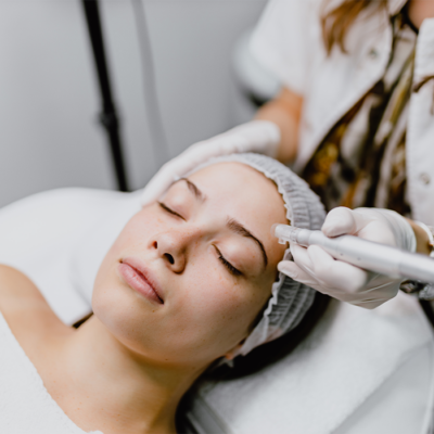 microneedling-tendencia