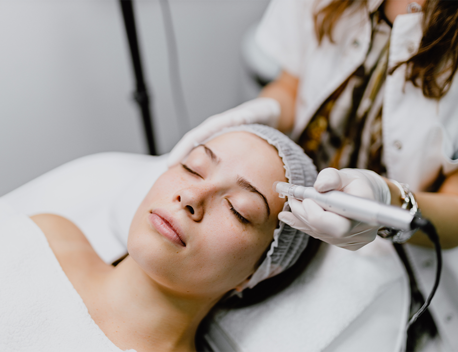 microneedling-tendencia