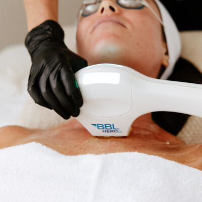 BBL Heroic facial