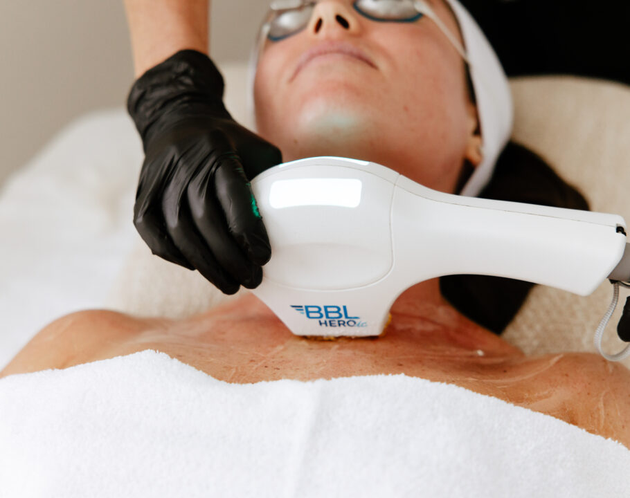 BBL Heroic facial