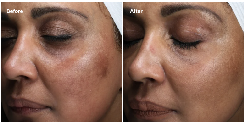 Skin Laundry Signature Facial