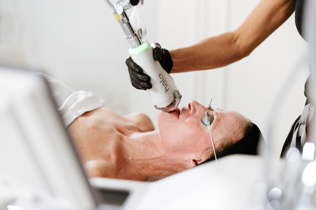 Así funciona Halo, el láser que mejora la textura, tono y firmeza de la piel en una sola sesión featured image