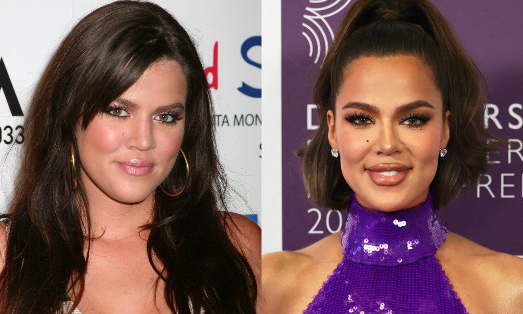 Khloé Kardashian revela cada cirugía y procedimiento estético a los que se ha sometido featured image