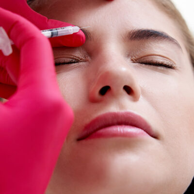 tendencia botox