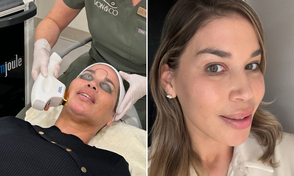 Este tratamiento con láser fue el glow-up que mi piel de 47 años necesitaba featured image
